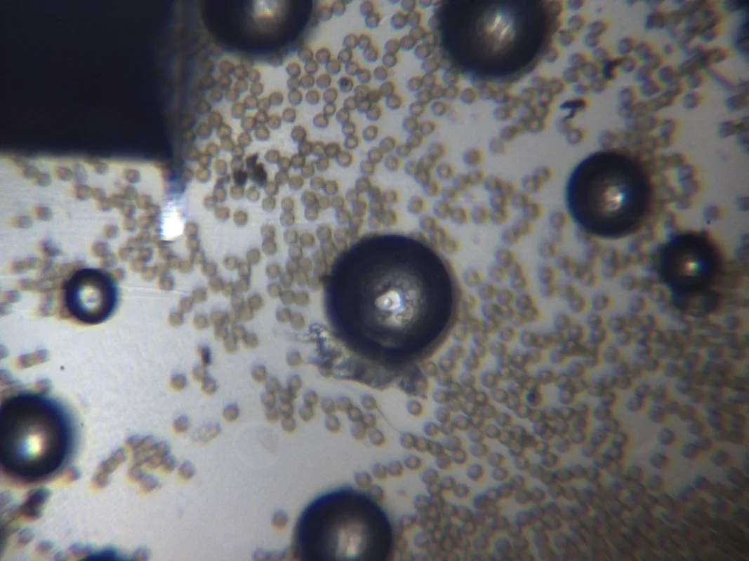 Pollen grains in liquid, as seen from the optical view. Using one of the asymmetric probes from Vmicro.